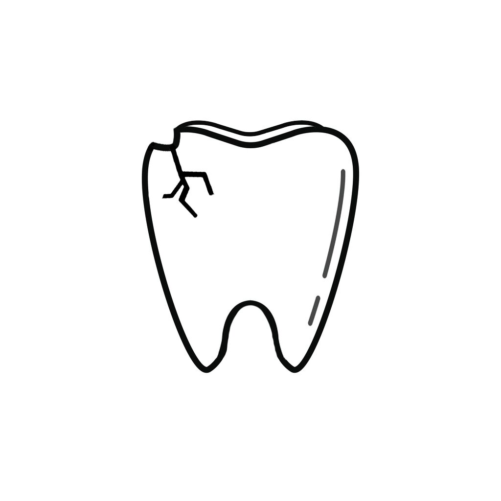 Storm Lake IA Dentist | I Chipped a Tooth! What Can I Do?